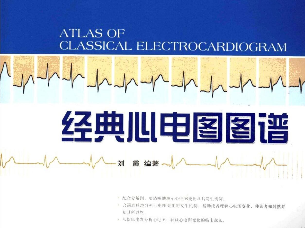经典心电图图谱  102 M